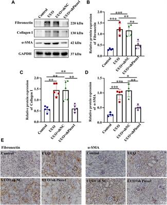 Targeting Mechanosensitive Piezo1 Alleviated Renal Fibrosis Through p38MAPK-YAP Pathway